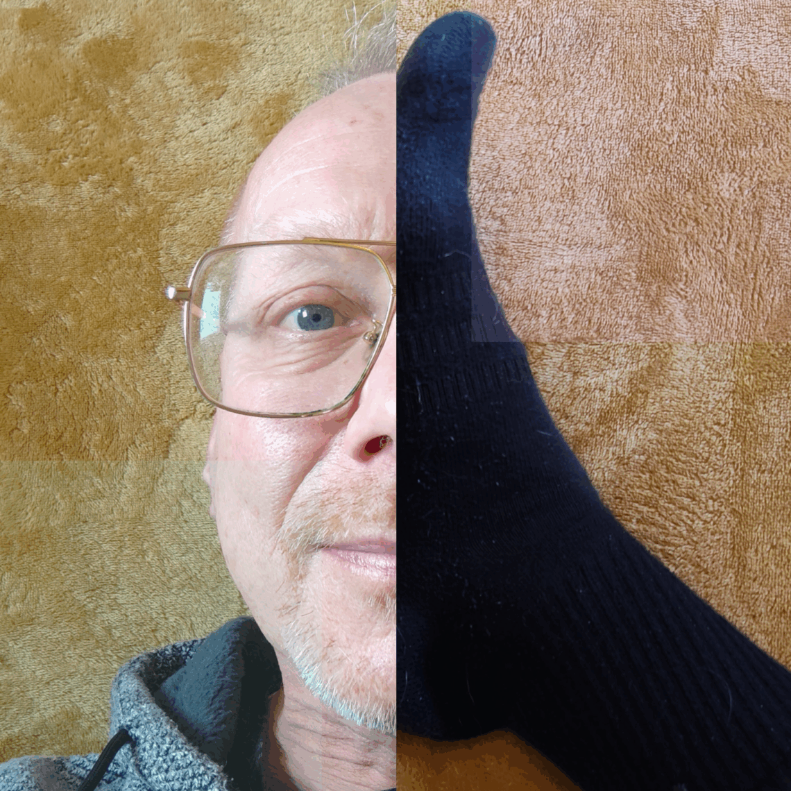 Urolige ben-syndrom / Restless Legs Syndrome