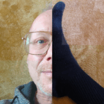 Urolige ben-syndrom / Restless Legs Syndrome